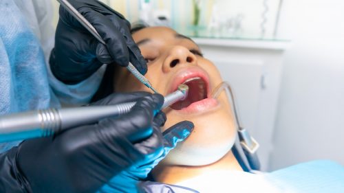 sedation dentistry