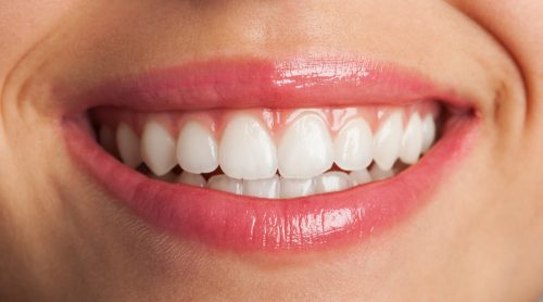 What causes yellow teeth